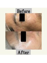 ペールノエル 富士宮店(PERENOEL)/VOSサロンケア(40代男性）