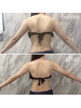 ラニ(LANI)/新型ハイパーナイフ6