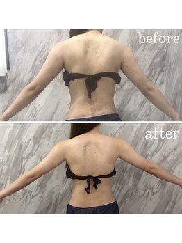 ラニ(LANI)/新型ハイパーナイフ6