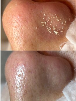 レンリー(Renry)/この汚れ取らない選択肢ある！？