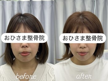 おひさま整骨院 整体院 姫路店/B＆A【姫路/小顔矯正/整体】