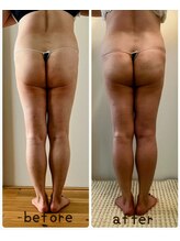 クリオネ(Clione)/愛されヒップ