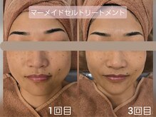 ルフ エステティック ビューティー(ruf esthetic beauty)の雰囲気(定期的なケアで理想のお肌に☆)
