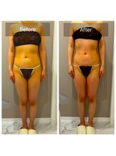 オーバイワン 横浜店/お客様BeforeAfter【1】