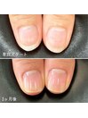 自爪育成ネイルケア