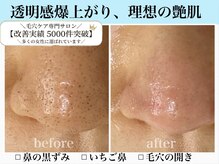 エミナル(eminal)