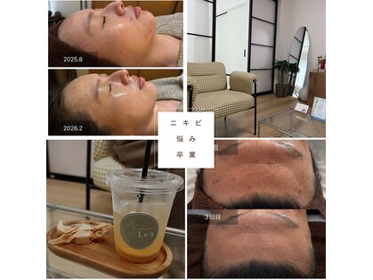 レア(Le'a)の写真