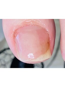 フットケアを受けたい