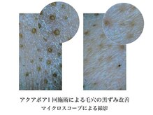 ピービー(PB)/毛穴洗浄