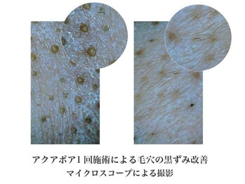 ピービー(PB)/毛穴洗浄