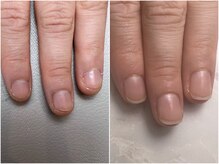 アンベリール(embellir.)/自爪育成コース