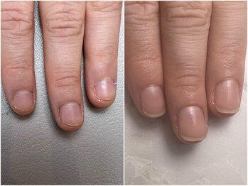 アンベリール(embellir.)/自爪育成コース