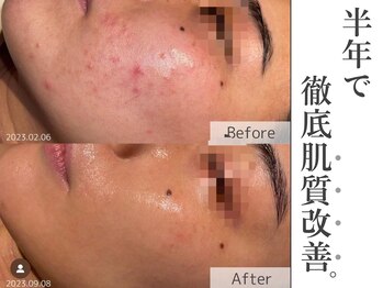 ビューティーサロンリア(LI'A)