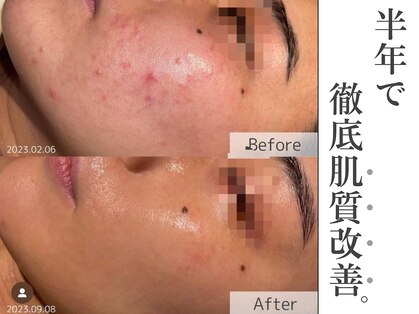 ビューティーサロンリア(LI'A)の写真