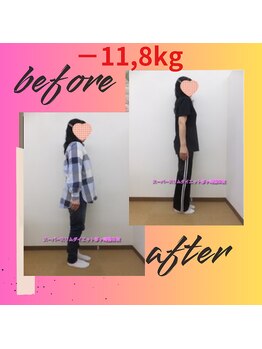 スーパースリムダイエット茅ヶ崎 茅ヶ崎整体院/3ヵ月－11,8ｋｇ減ダイエット♪