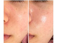 スリリアン 銀座/★お客さまビフォーアフター★