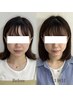 【エラ張り・左右差・お顔の歪み】小顔矯正＋ヘッドスパ90分　