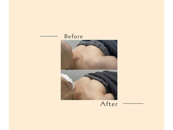 オベリオ(OBERIO)/