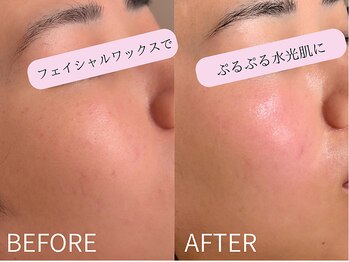 ケアズ(CARES)/ハイライト要らずの水光肌に