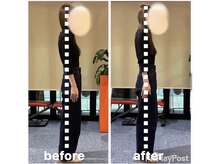 カワル整体 上通り院/【反り腰改善と広背筋の役割】