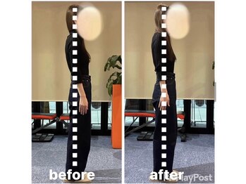 カワル整体 上通り院/【反り腰改善と広背筋の役割】