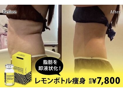 ミラヴィエ(Miravie)の写真