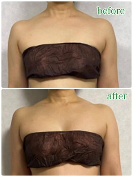 ウェルフィットの写真/マシュマロバスト気持ち良く育む！バストを出さずに理想のラインへ♪