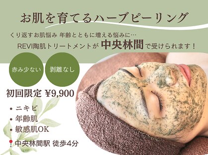 ハミングスキン(Humming skin)の写真