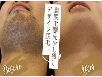 ラフラフ(Laf Laf)の写真/清潔感は“武器”。青ひげ卒業で印象が変わる。