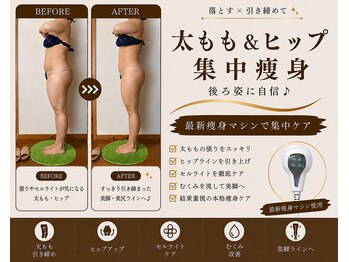 メリッサ(Melissa)の写真/太もも・ヒップ・下半身のむくみやセルライトが気になる方へ♪