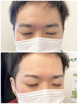 アイビー 人形町店(i.b)/眉【before⇒after】１１４