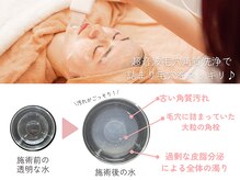 ミュー 名駅店(mieux)/毛穴角質洗浄