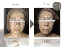 ビューティーリバース 二俣川店/★劇的ビフォーアフター★