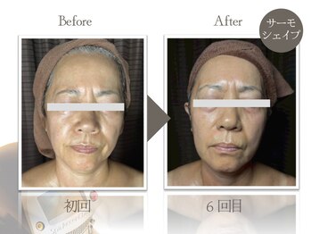 ビューティーリバース 二俣川店/★劇的ビフォーアフター★