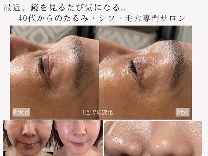 シェリ フルール(Cheri Fleur)の写真