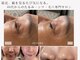 シェリ フルール(Cheri Fleur)の写真