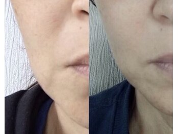 サロン リーナ 北千住店(Salon Lena)/こだわりの自社製品VinatuleW-UP