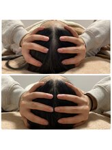 らくカモ/『1回の施術』before after