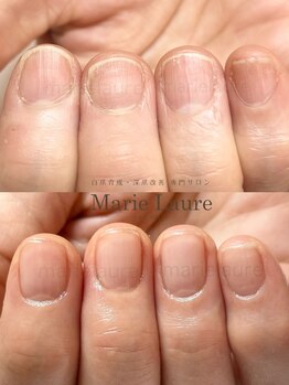 マリーロール 淀屋橋本店(Marie Laure)/自爪育成/深爪矯正/ネイルケア