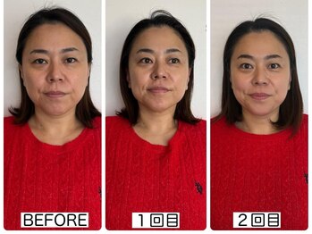 エミナル(EMINAL)/小顔リンパコルギ準備中［練馬］