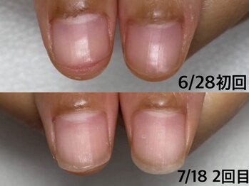 エヌ(N)/ネイリストMami限定