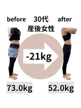 かえで接骨院 石山院/30代産後ママのダイエット