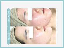 スリムライン 秋田店(The Slim Line)/before→after