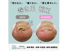 ミント 岐阜大垣店(minto)の雰囲気（その日にすぐ実感！初回施術からの即効性）