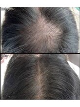 キュライム 熊本(CURAIM)/育毛促進【60代女性】