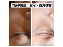 ARIS 【アリス】高松店