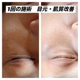 アリス 高松店(ARIS)