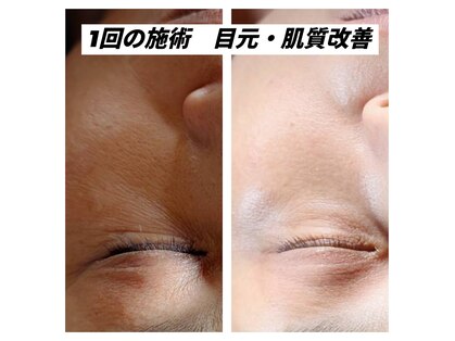 ARIS 【アリス】高松店の写真