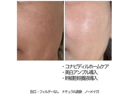 エンドット(EN.)の写真