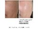 エンドット(EN.)の写真